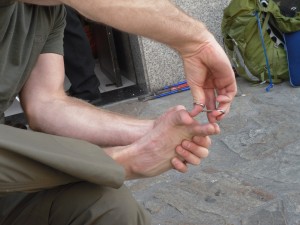 Camino de Santiago - Foot Surgery